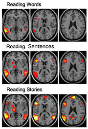 Brain maps, Allen R. Braun, M.D.